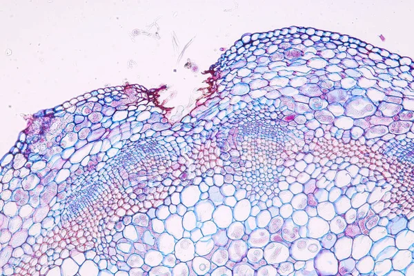 Zygomycota Μύκητες Zygote Downy Ωίδιο Του Ιστού Ξενιστή Cruzifers Conidia — Φωτογραφία Αρχείου