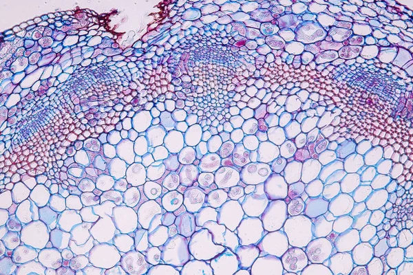 Zygomycota Zygote 곰팡이 갑각류 Downy Mildew 조직을 가지고 교육을 현미경 — 스톡 사진