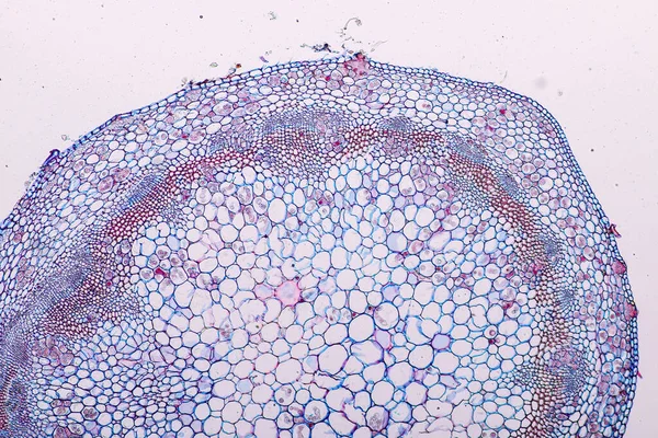 Zygomycota Funghi Zigote Peronospora Downy Croziferi Ospitano Tessuto Con Conifere — Foto Stock