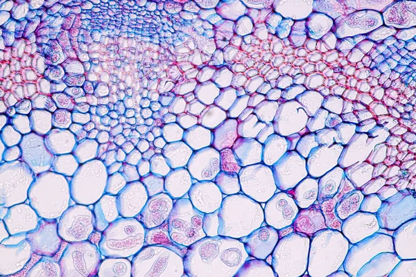 Zygomycota Fungos Zigotos Míldio Downy Tecido Hospedeiro Cruzifers Com Conídios — Fotografia de Stock