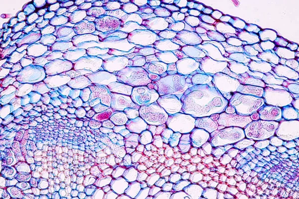 Zygomycota Oder Zygote Pilze Falscher Mehltau Von Kruziferen Wirtsgewebe Mit — Stockfoto
