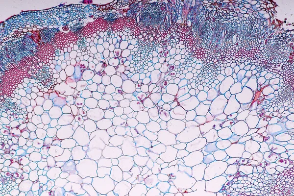 Zygomycota, or zygote fungi ,Downy mildew of cruzifers host tissue with conidia living in decaying plant on Slide under the microscope for education.