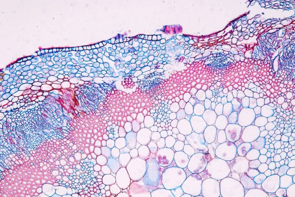 Zygomycota Μύκητες Zygote Downy Ωίδιο Του Ιστού Ξενιστή Cruzifers Conidia — Φωτογραφία Αρχείου