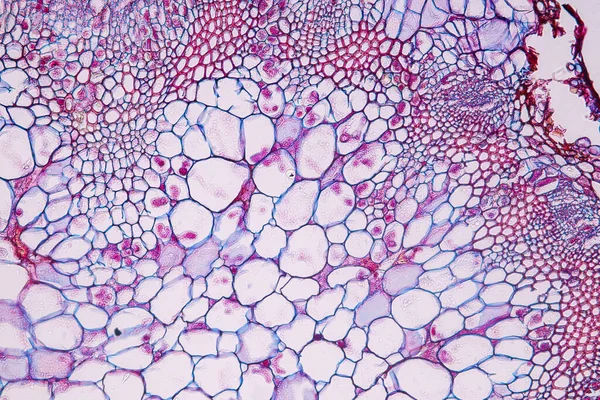 Zygomycota Μύκητες Zygote Downy Ωίδιο Του Ιστού Ξενιστή Cruzifers Conidia — Φωτογραφία Αρχείου