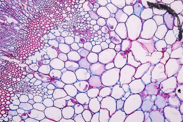 Zygomycota Zygote 곰팡이 갑각류 Downy Mildew 조직을 가지고 교육을 현미경 — 스톡 사진