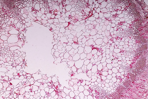 Zygomycota Funghi Zigote Peronospora Downy Croziferi Ospitano Tessuto Con Conifere — Foto Stock