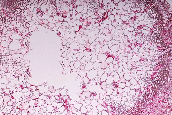 Zygomycota, or zygote fungi ,Downy mildew of cruzifers host tissue with conidia living in decaying plant on Slide under the microscope for education.