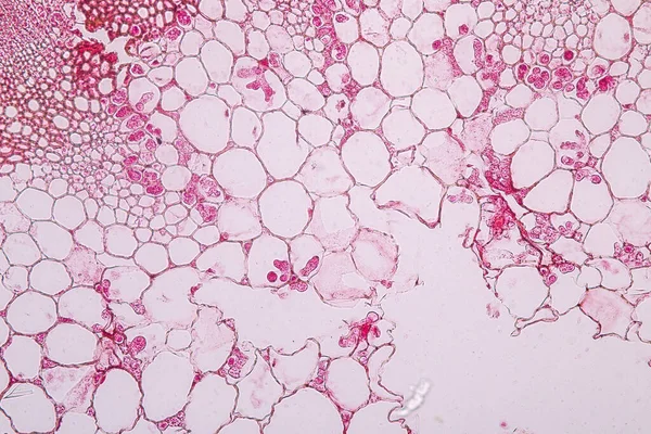 Zygomycota Hongos Cigotos Mildiu Downy Cruzifers Acogen Tejido Con Conidios — Foto de Stock