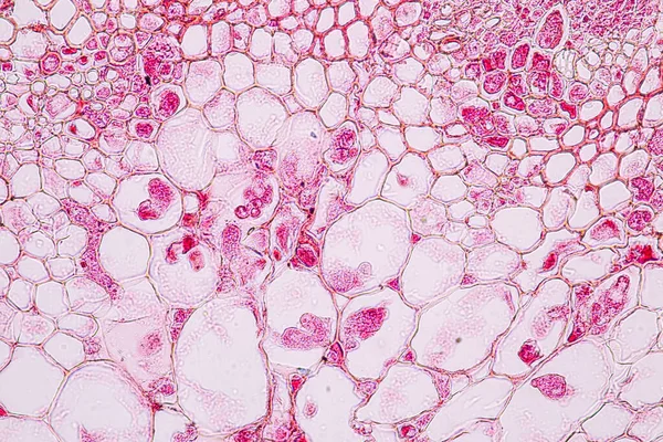 Zygomycota Μύκητες Zygote Downy Ωίδιο Του Ιστού Ξενιστή Cruzifers Conidia — Φωτογραφία Αρχείου