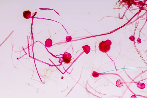 Rhizopus Özellikleri Eğitim Için Mikroskop Altında Kayan Yaygın Bir Safirik — Stok fotoğraf