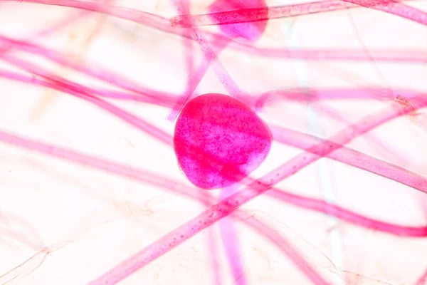 Характеристики Rhizopus Род Распространенных Сапрофилактических Грибов Слайде Микроскопом Образования — стоковое фото