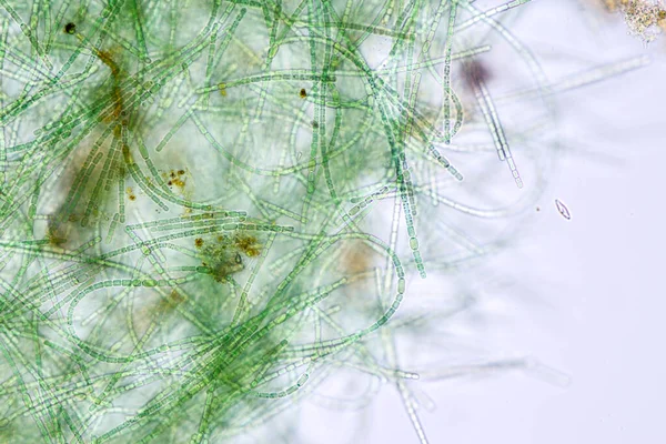 Anabaena, eğitim için mikroskop altında kayan lifli bir siyanobakteri cinsidir..