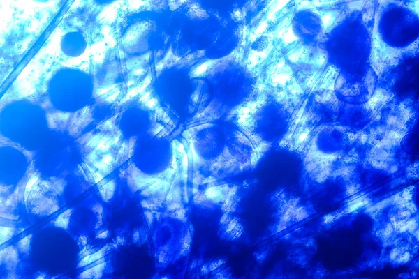 Характеристики Rhizopus Рід Поширених Сапрофітичних Грибів Слизі Під Мікроскопом Освіти — стокове фото