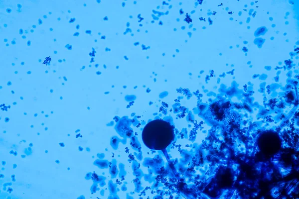 Características Rhizopus Género Hongos Saprofitos Comunes Slide Bajo Microscopio Para — Foto de Stock