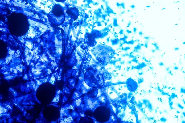 地下茎の特徴は 教育のための顕微鏡下でスライド上の一般的な腐生菌の属です — ストック写真