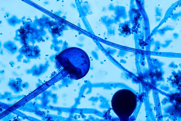 Charakteristika Rhizopus Rod Běžných Saprofytických Hub Slide Pod Mikroskopem Pro — Stock fotografie