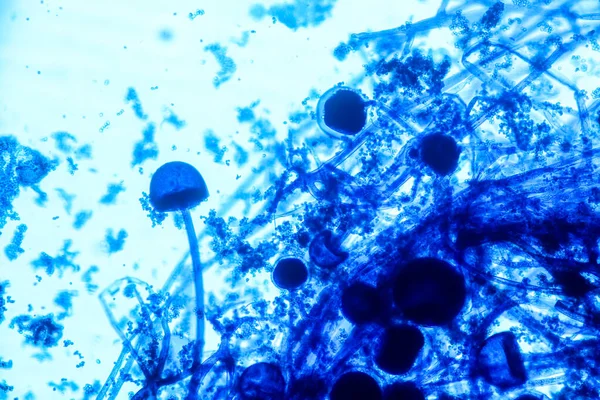 Caratteristiche Rhizopus Genere Funghi Saprofiti Comuni Scivolo Microscopio Educazione — Foto Stock