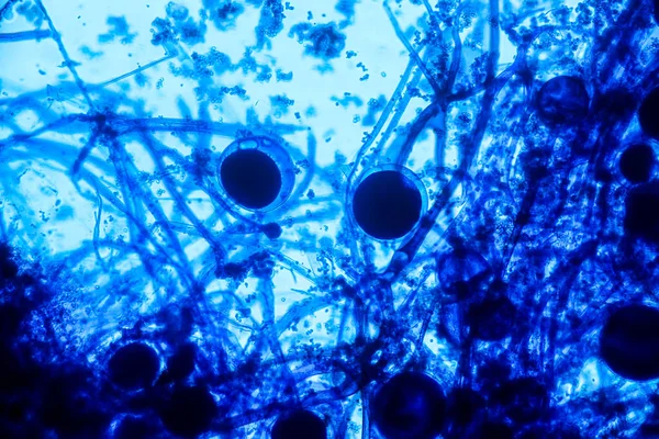 地下茎の特徴は 教育のための顕微鏡下でスライド上の一般的な腐生菌の属です — ストック写真