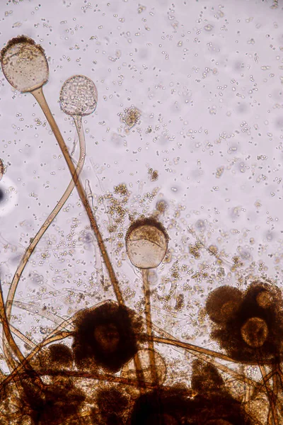 Características Rhizopus Género Hongos Saprofitos Comunes Slide Bajo Microscopio Para —  Fotos de Stock
