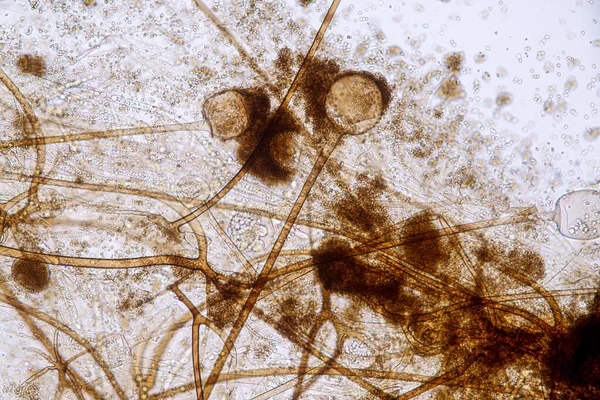 Características Rhizopus Gênero Fungos Saprófitos Comuns Slide Sob Microscópio Para — Fotografia de Stock