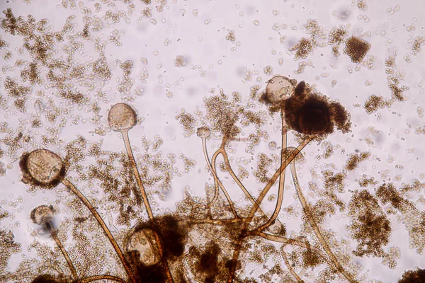 地下茎の特徴は 教育のための顕微鏡下でスライド上の一般的な腐生菌の属です — ストック写真