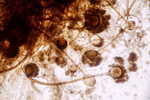地下茎の特徴は 教育のための顕微鏡下でスライド上の一般的な腐生菌の属です — ストック写真