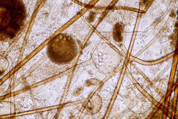 Características Rhizopus Gênero Fungos Saprófitos Comuns Slide Sob Microscópio Para — Fotografia de Stock