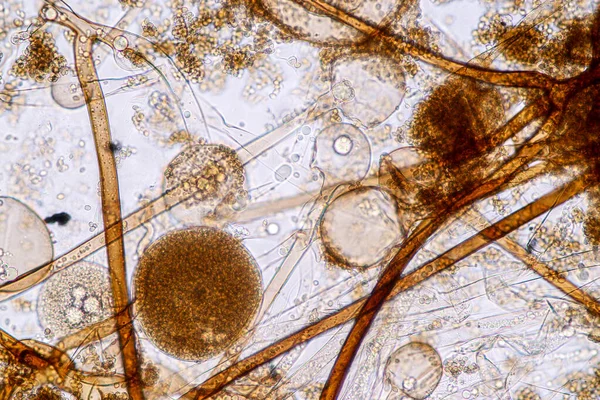 Características Rhizopus Gênero Fungos Saprófitos Comuns Slide Sob Microscópio Para — Fotografia de Stock