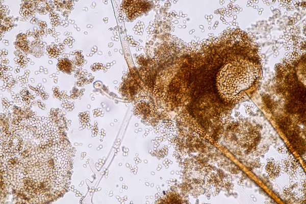 Charakterystyka Rhizopus Jest Rodzajem Grzybów Saprofitycznych Slide Pod Mikroskopem Edukacji — Zdjęcie stockowe