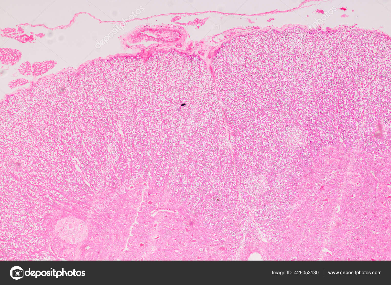 Top 10 Spinal Cord Injury Treatment PowerPoint Presentation Templates in  2026, image size:1600x1167