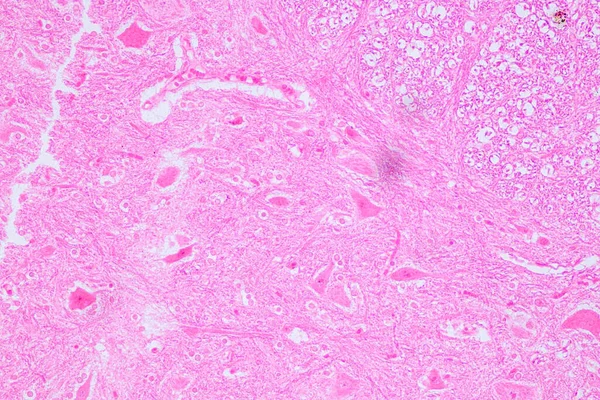 Educación Médula Espinal Neurona Motora Bajo Microscopio Laboratorio — Foto de Stock