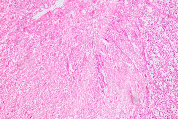 Educación Médula Espinal Neurona Motora Bajo Microscopio Laboratorio —  Fotos de Stock