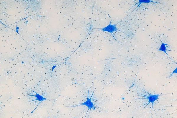 Onderwijs Spinal Cord Motor Neuron Onder Microscoop Lab — Stockfoto