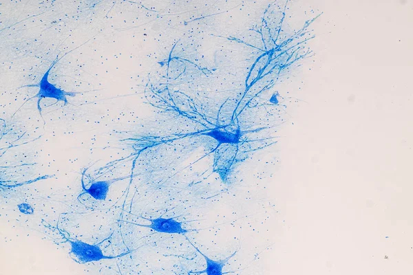 Εκπαίδευση Νωτιαίου Μυελού Και Motor Neuron Κάτω Από Μικροσκόπιο Στο — Φωτογραφία Αρχείου
