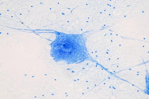 Educação Cordão Espinhal Neurônio Motor Sob Microscópio Laboratório — Fotografia de Stock