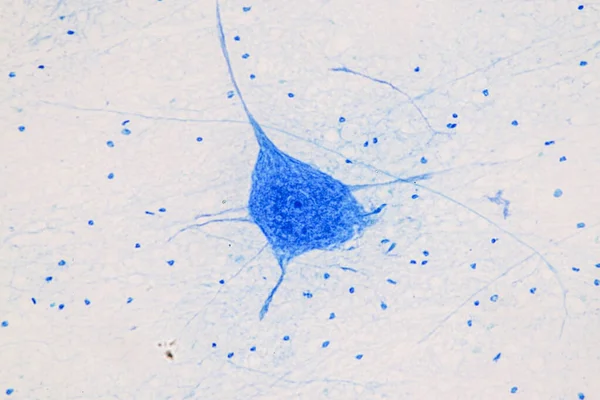 실험실에 현미경 아래있는 교육용 척추와 운동용 신경교종 — 스톡 사진