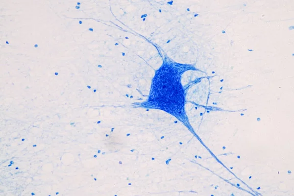 教育研究室の顕微鏡下で脊髄と運動ニューロン — ストック写真