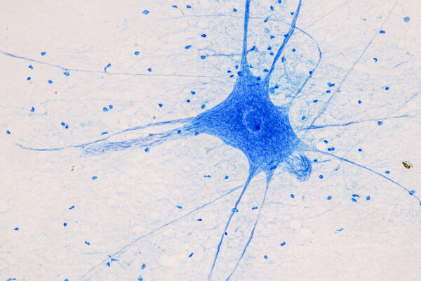 Education Spinal cord  and Motor Neuron under the microscope in Lab.