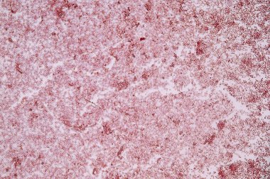 Sümük kalıpları, bir grup olarak, eğitim için mikroskop altında polifiletiktir..