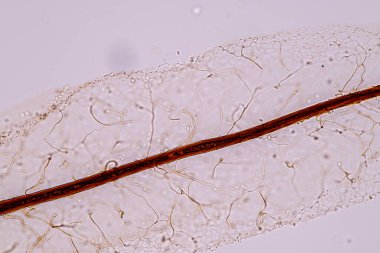 Sümük kalıpları, bir grup olarak, eğitim için mikroskop altında polifiletiktir..