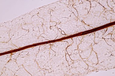 Sümük kalıpları, bir grup olarak, eğitim için mikroskop altında polifiletiktir..