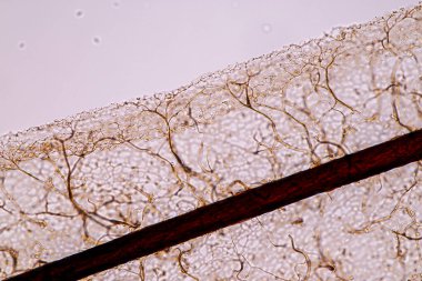 Sümük kalıpları, bir grup olarak, eğitim için mikroskop altında polifiletiktir..