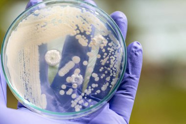 Pichia, Saccharomycetaceae familyasından bir maya cinsidir..