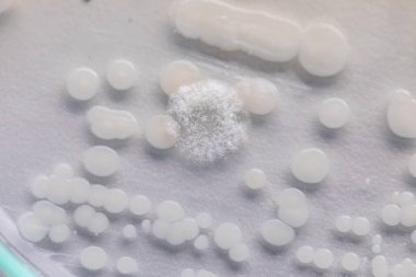Pichia, Saccharomycetaceae familyasından bir maya cinsidir..