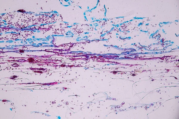 Schleimpilze Als Gruppe Sind Polyphyletisch Unter Dem Mikroskop Für Die — Stockfoto