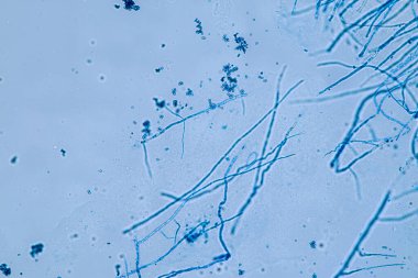 Penisilyum, ascomycetous mantarlar gıda ve uyuşturucu üretiminin yanı sıra doğal ortamda da büyük önem taşımaktadır..