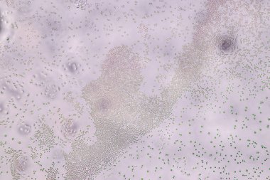 Penisilyum, ascomycetous mantarlar gıda ve uyuşturucu üretiminin yanı sıra doğal ortamda da büyük önem taşımaktadır..