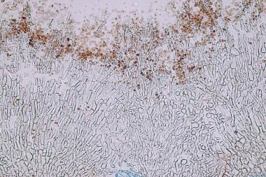 Penisilyum, ascomycetous mantarlar gıda ve uyuşturucu üretiminin yanı sıra doğal ortamda da büyük önem taşımaktadır..