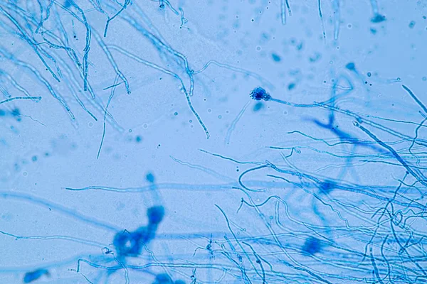 Penicillium Ascomycetous Μύκητες Είναι Μείζονος Σημασίας Για Φυσικό Περιβάλλον Καθώς — Φωτογραφία Αρχείου