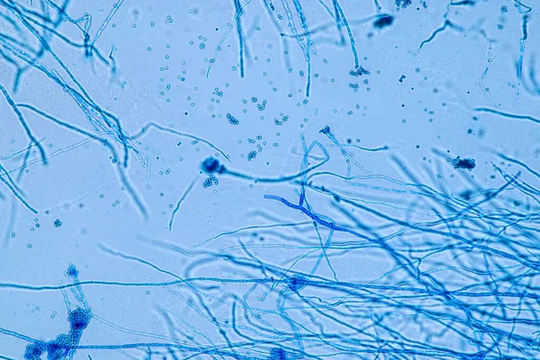 Penicillium Ascomycetous Μύκητες Είναι Μείζονος Σημασίας Για Φυσικό Περιβάλλον Καθώς — Φωτογραφία Αρχείου